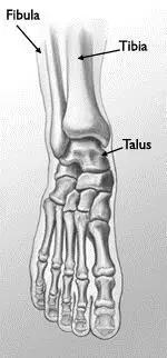 几种严重骨折医学名称,常见的骨折有哪些名称