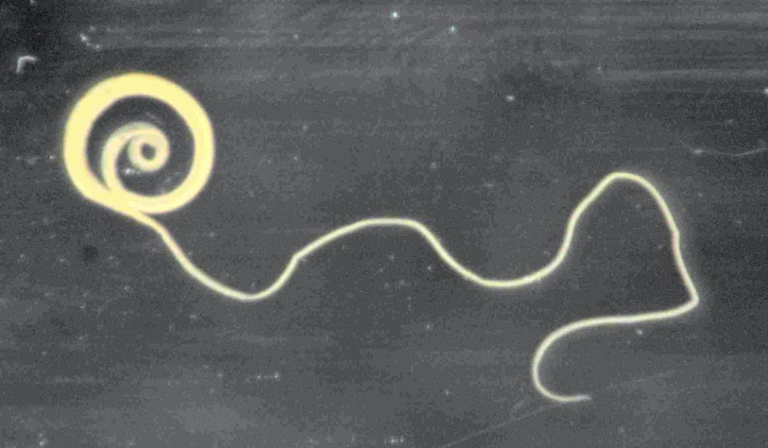 他们生吞3500寄生虫卵，花费1.5万元，只为治疗秃头