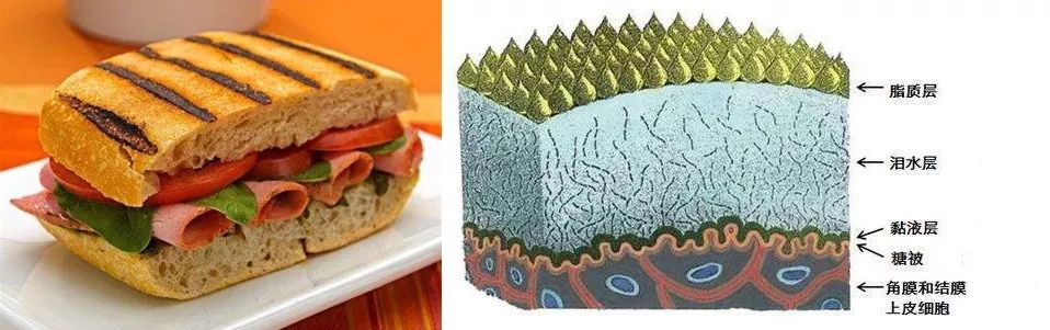 干眼症可以彻底治愈吗,干眼症能彻底治好吗