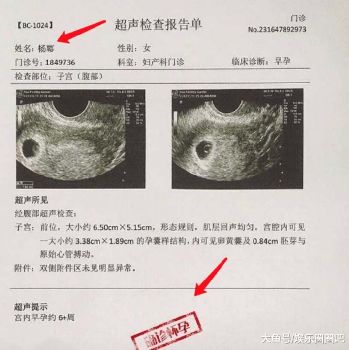 杨幂被曝怀二胎,杨幂被传怀二胎