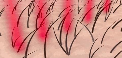 腿毛可以检测吸毒么,一根头发可以检测吸毒了吗