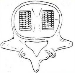 腰椎间盘突出症的临床诊治策略,腰椎间盘突出症的临床诊治