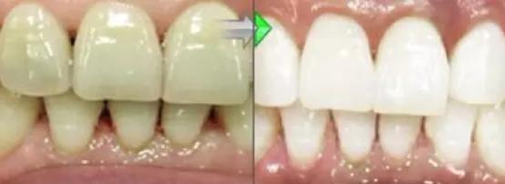 杨颖和姚晨演技,姚晨和杨颖谁的嘴巴大