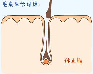 经常熬夜导致脱发如何解决,肾虚熬夜脱发怎么治疗