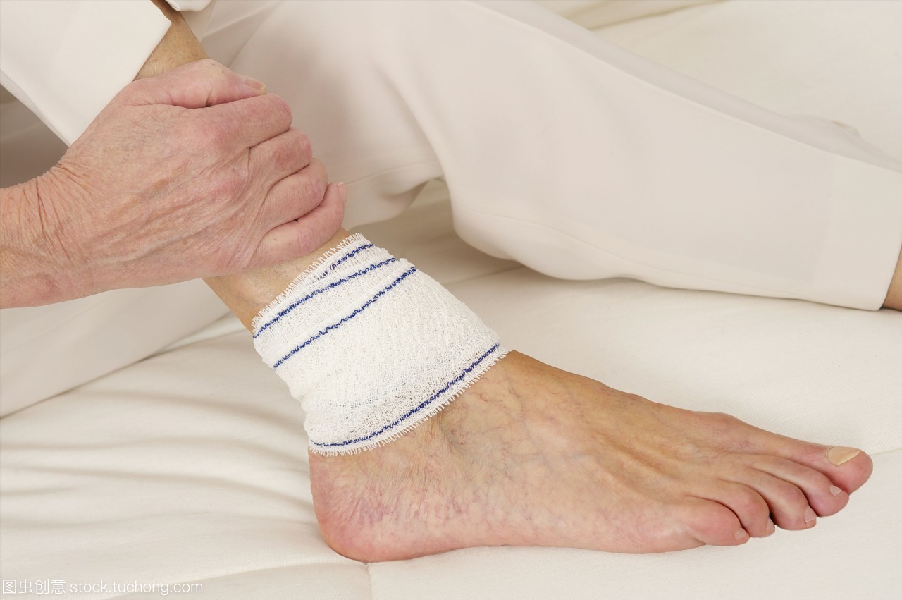 跌打扭伤筋怎么办,跌打扭伤肌肉酸痛怎么快速恢复