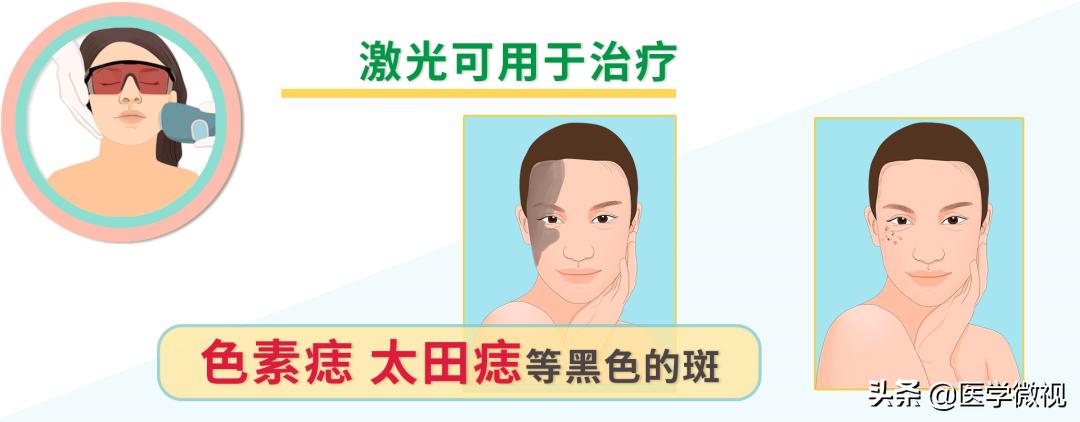 猕猴桃女孩腋下脱毛,猕猴桃女孩轻松脱毛的救星