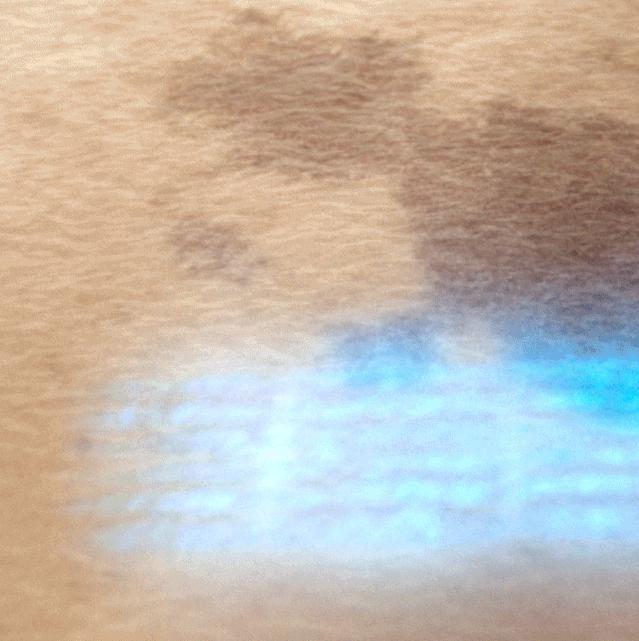 瞬间让脸变白的神器,让斑快速消失