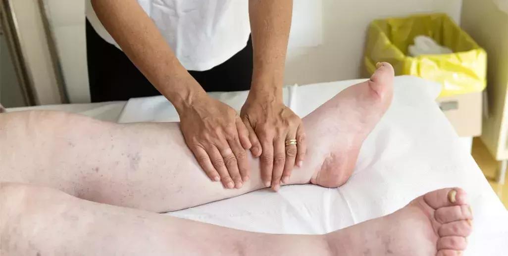 激素药膏太恐怖,激素药物那么可怕为什么要用激素