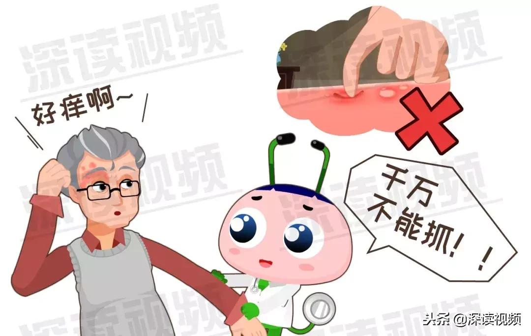 带状疱疹疫苗得了后能打吗,带状疱疹疫苗都可以打吗