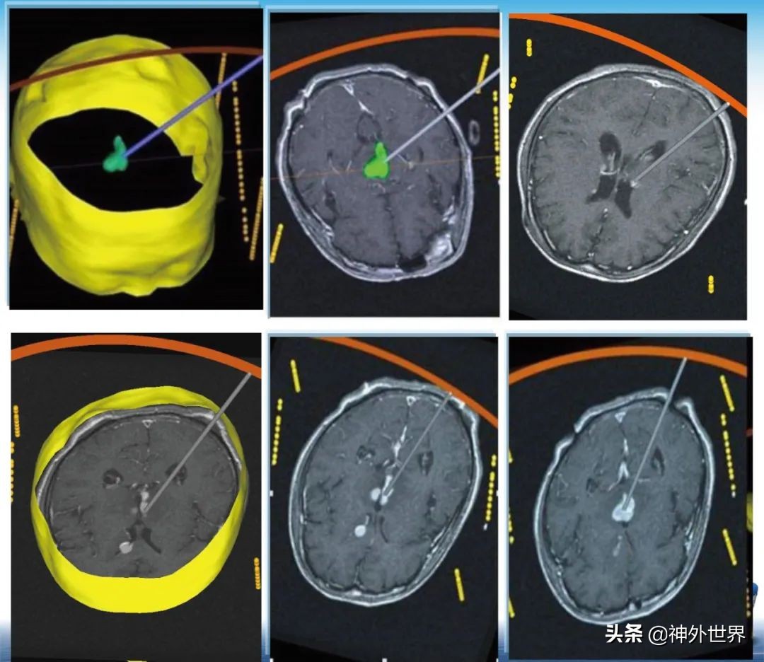 宣武医院神经外科王亚明祖籍,北京宣武医院神经科专家王亚明