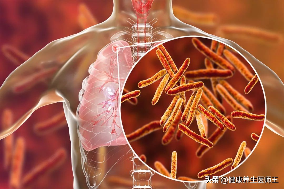 急性肺损伤诊断标准,急性肺损伤辨证