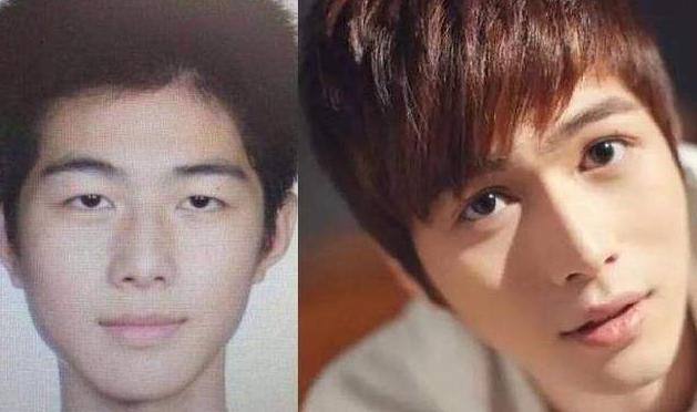 为啥三甲医院做的双眼皮更美,南华博士含金量