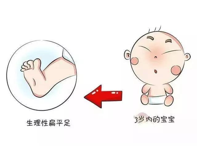 扁平足孩子的足部问题,儿童脚部知识