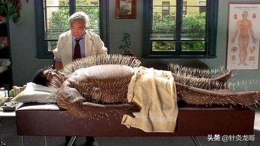 针灸一定要补或者泻吗,针灸扎到穴位通过什么可以治病