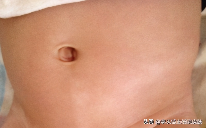 身上有几块白斑能被确诊白癜风,身上白色斑块怎么排除白癜风