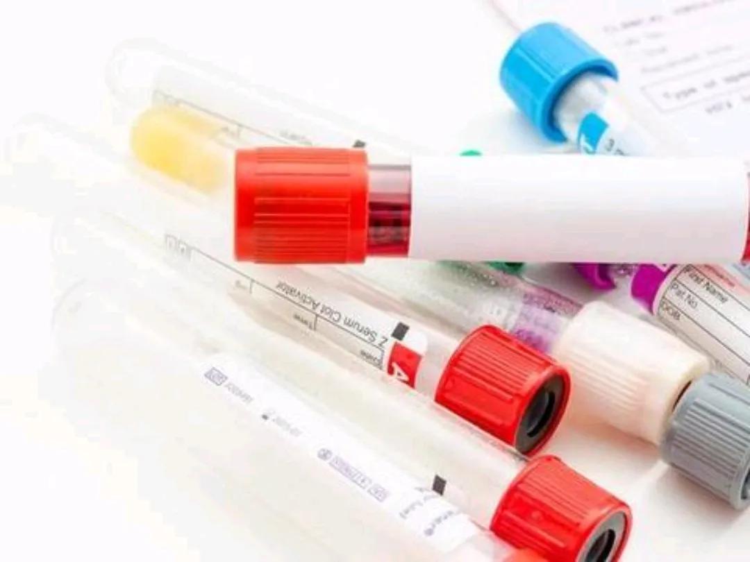 吃阿司匹林尿酸高吃什么中药,长期吃阿司匹林引起尿酸高怎么办