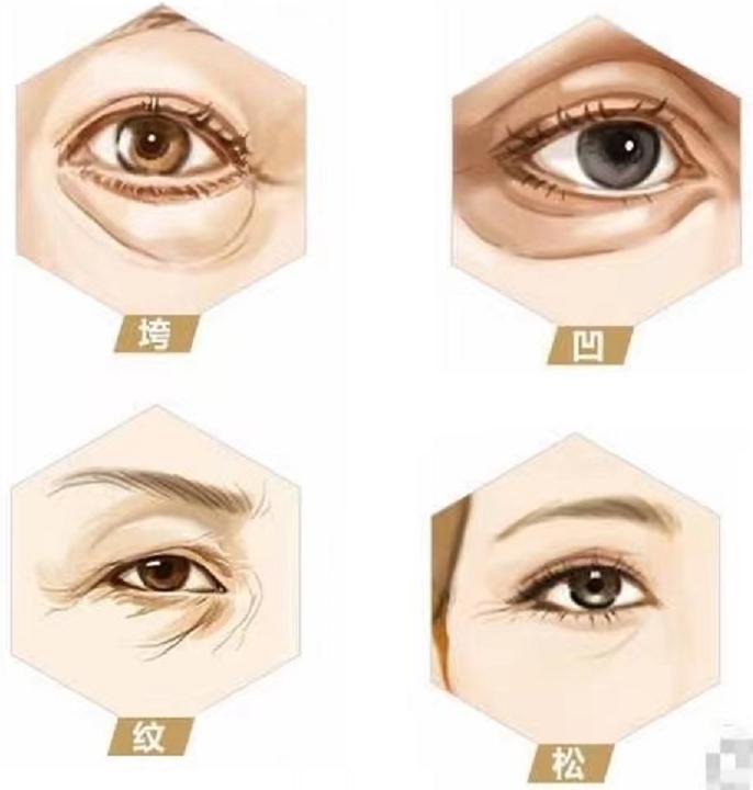 上海九院哪个专家修复眼外翻好,上海九院做眼睛修复最好医生