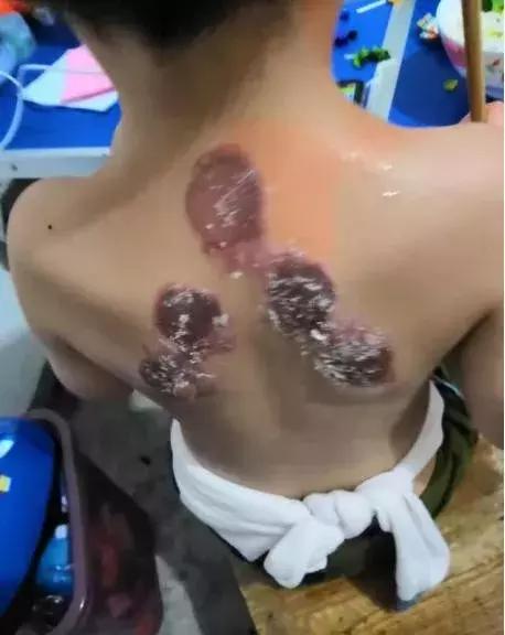 健康小常识小心烫伤,健康常识骗了多少人