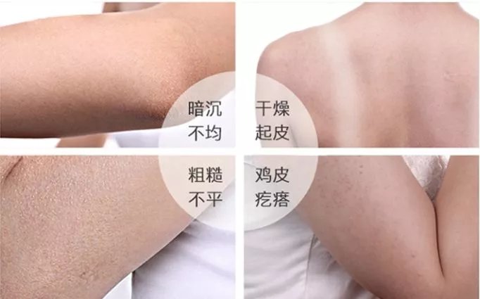 身体护理鸡皮肤,身体保湿大作战