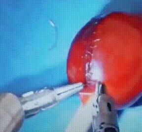 林黛玉重病咳血,林黛玉肺癌