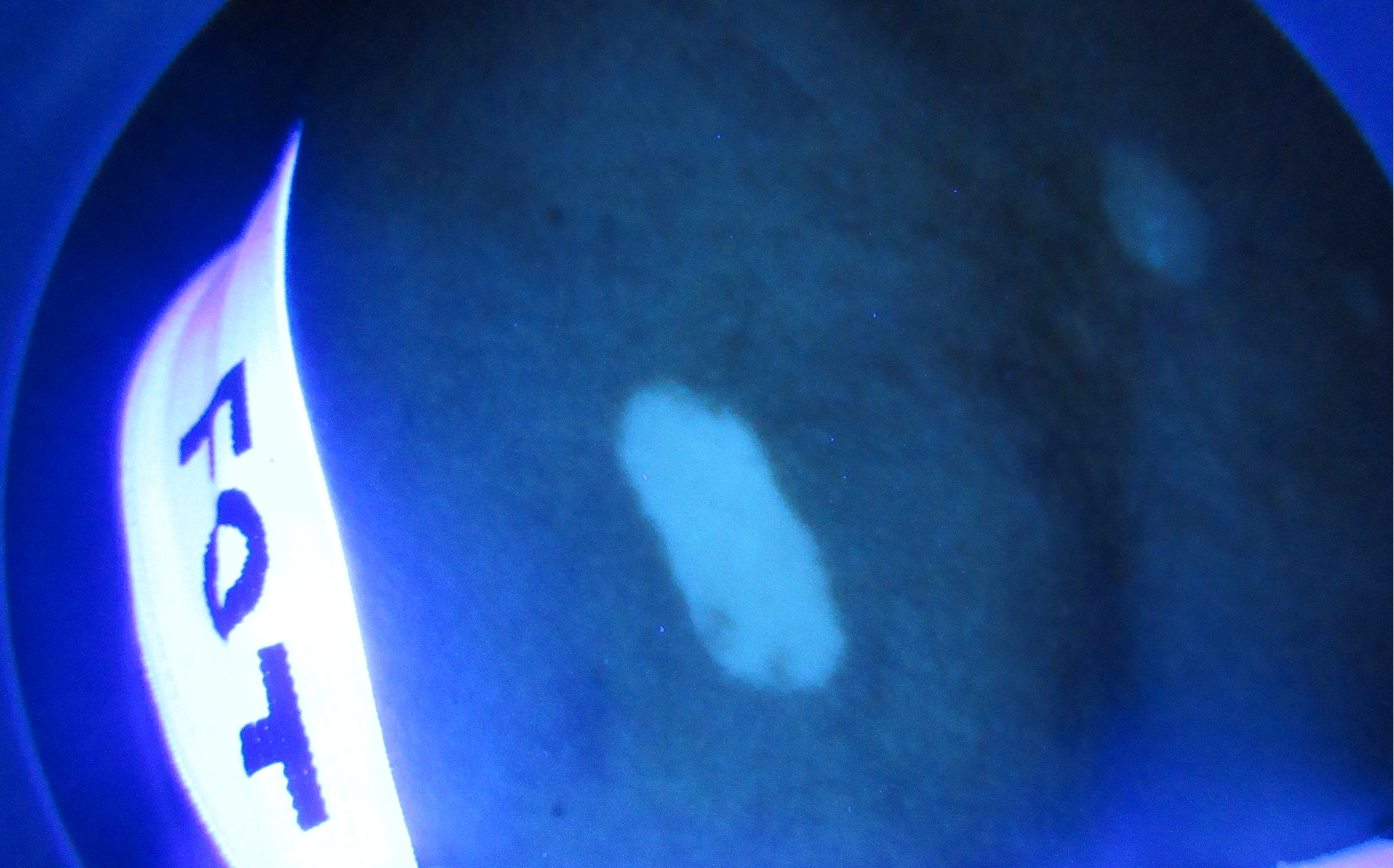 孩子身上长白斑怎么治疗,两岁宝宝身上有块白斑是怎么回事