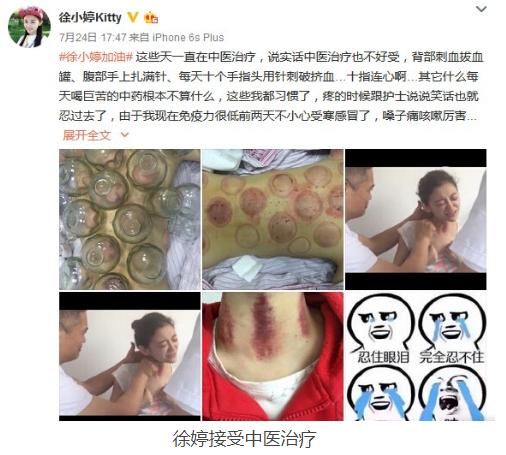 徐婷因什么病去世,徐婷被杀