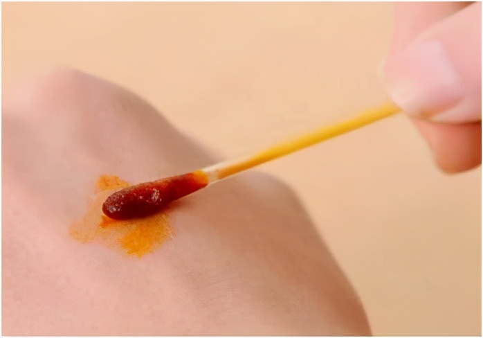 皮肤擦伤有渗出液,皮肤擦伤涂什么药