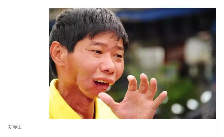 槟榔加烟的危害词语,槟榔加烟有什么危害