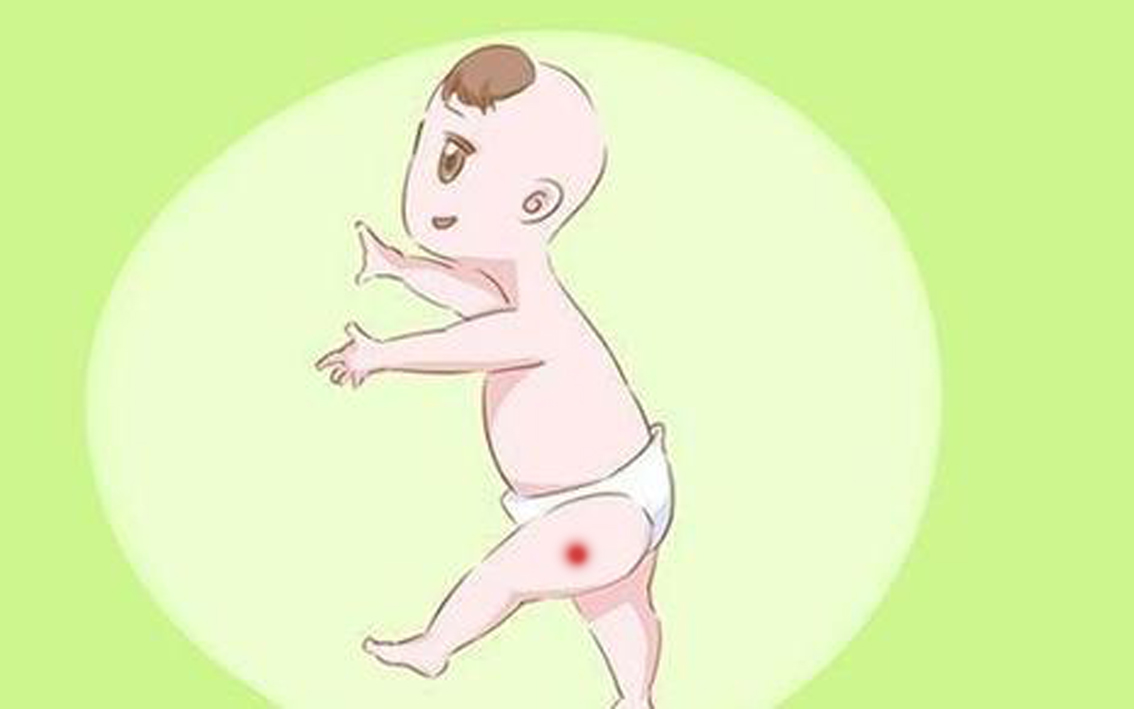 宝宝血管瘤治疗好了还有点青,婴儿得了血管瘤能治好吗