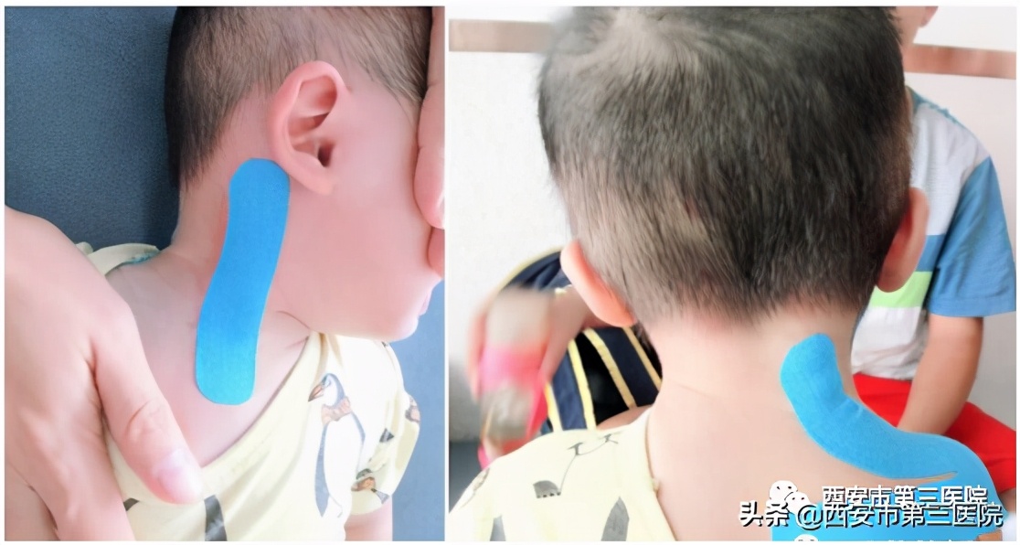 育儿推拿的正确方法,育儿知识孩子头型矫正