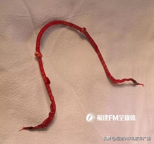 福建省级机关医院二甲,福建省级机关医院有哪些