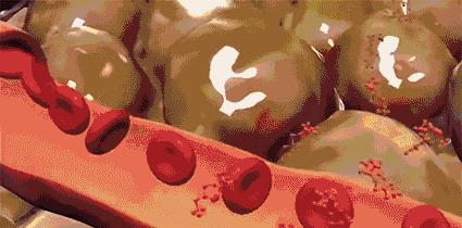 吴昕怎么改善o型腿,吴昕是怎么减掉小粗腿