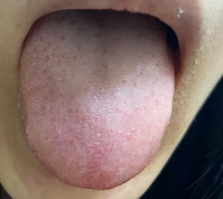 大姨妈太多身体虚弱,大姨妈过多怎么补气血