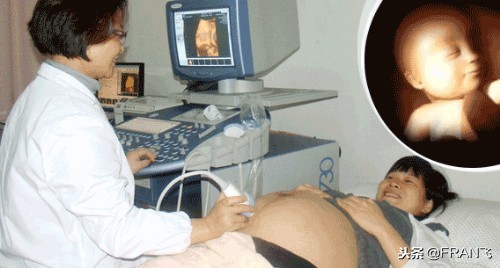 “四维彩超”主要查这些，准妈妈你都知道吗？