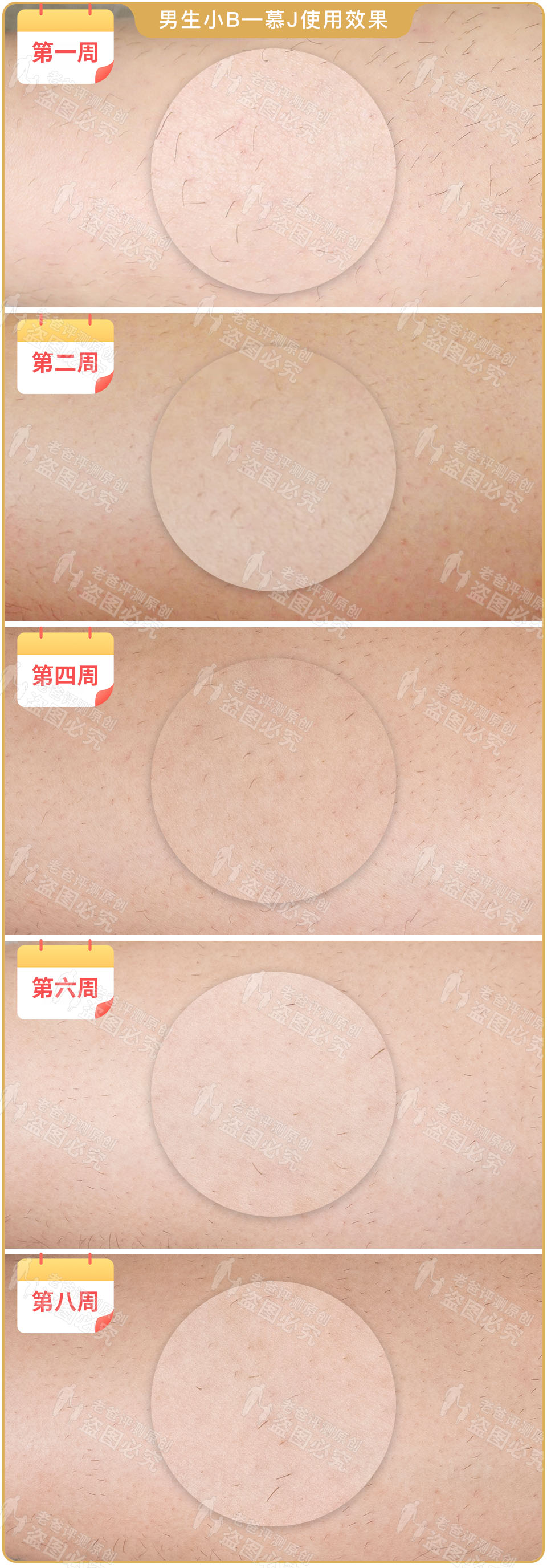 最真实的脱毛仪,bequeen脱毛仪实测