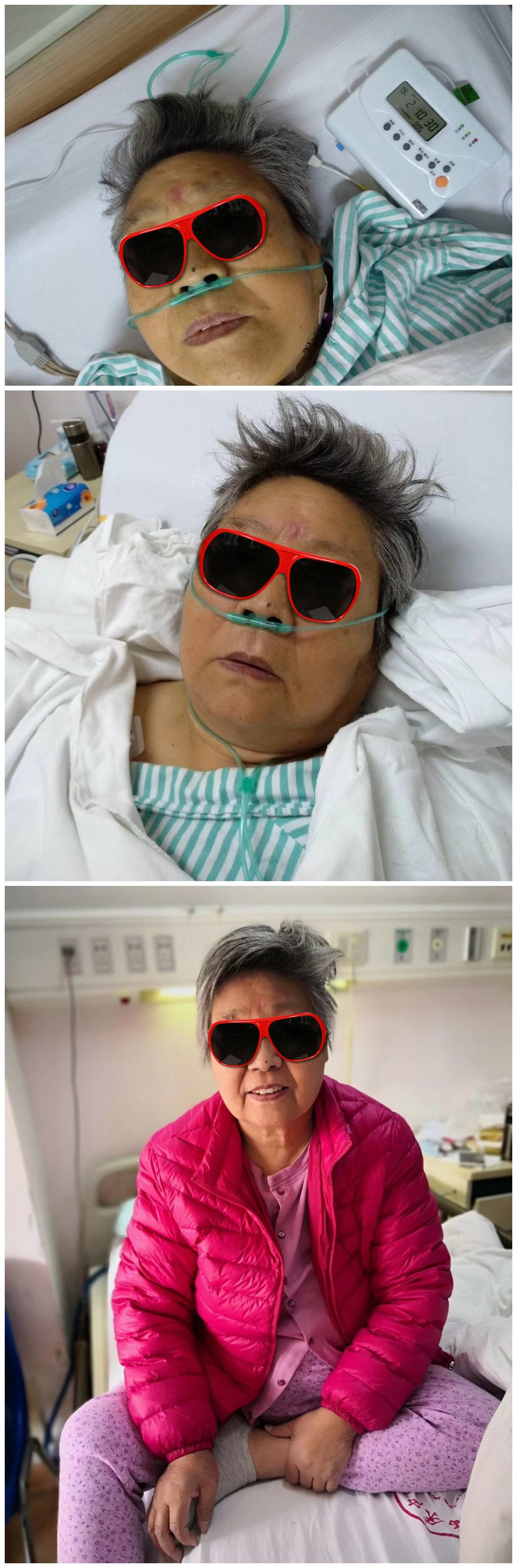 肝硬化顽固性腹水的临床研究,肝硬化失代偿糖尿病最新治疗方案