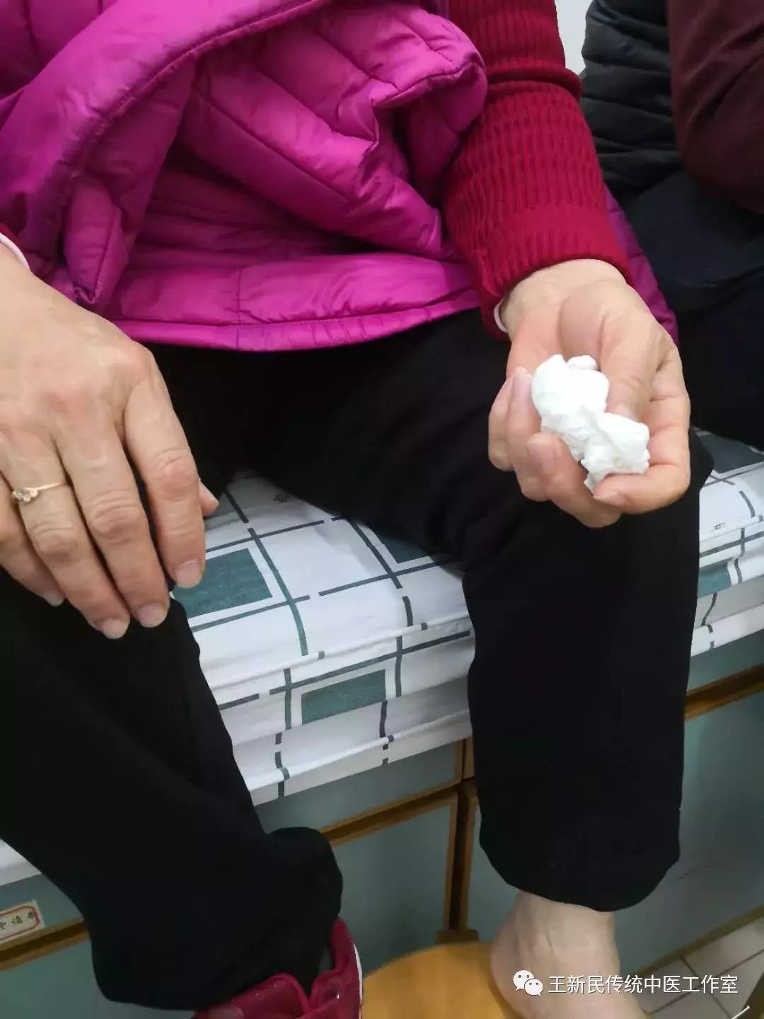 王新民中医专栏|为什么她的胃里面总是怕冷？