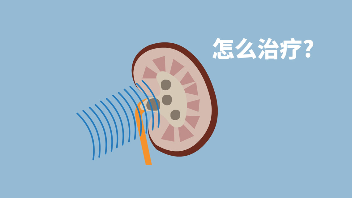 9毫米结石可以用冲击波打碎吗,体外冲击波治疗多大结石可以碎