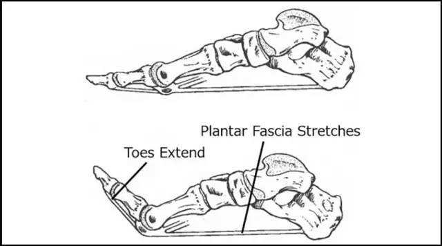 骨刺与跖筋膜炎怎么治疗,足跟痛骨刺与跖筋膜炎