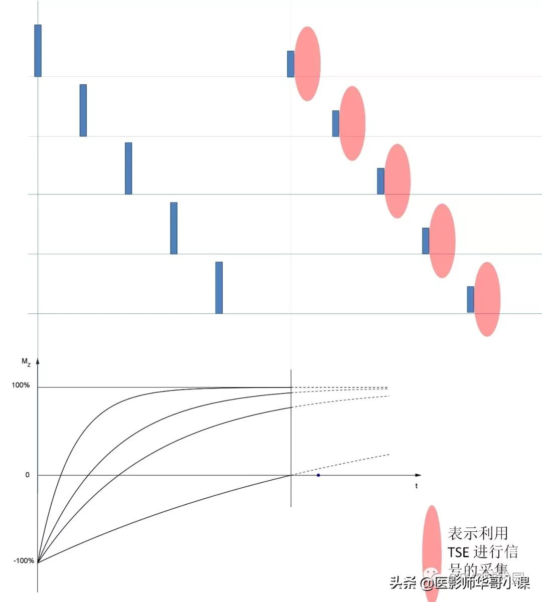 「MRI技术」磁共振伪影分析,了解下SSh_FLAIR序列