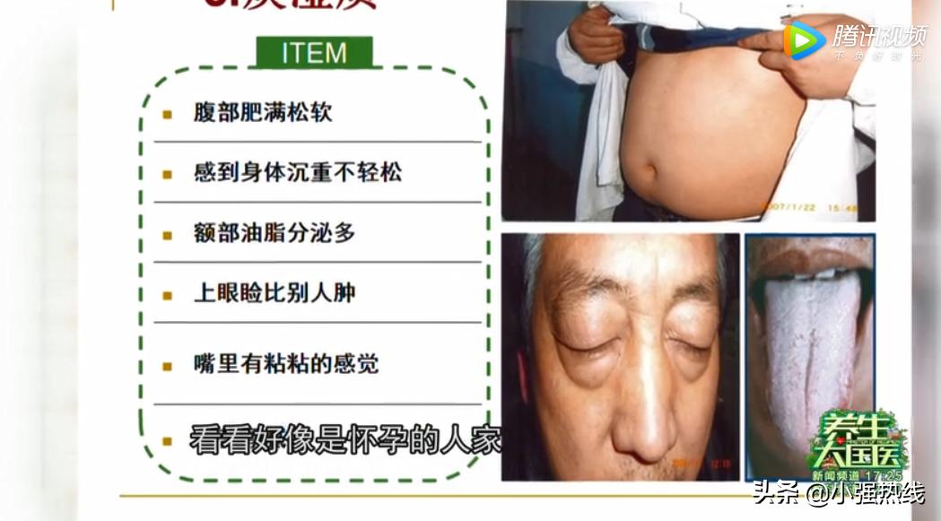 每次减肥瘦不了？喝水都长肉？“易胖体质”太吃亏，中医小方健脾利湿，调理体质轻松瘦