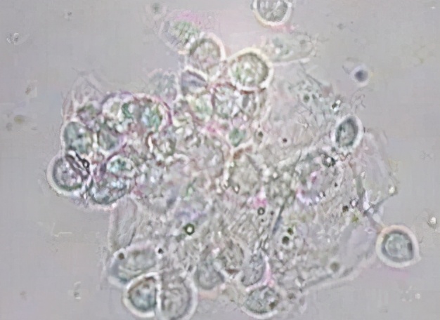 妇幼保健院的白带常规报告解读,妇幼保健院能查白带常规么
