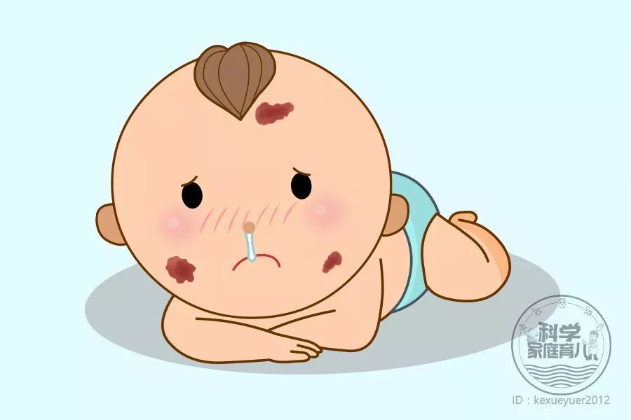 如何避免婴儿脸上胎记和长痣,胎记痣形成的原因