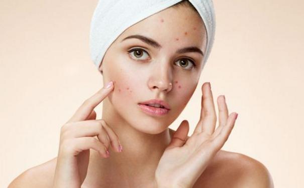 闭口毛孔粗大怎么去角质,闭口痘痘皮肤粗糙毛孔粗大