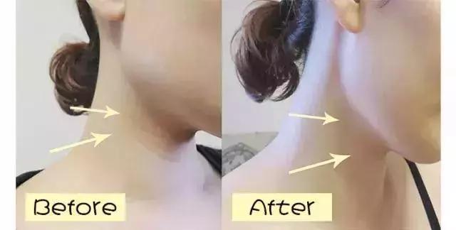 护肤反而皮肤差,改掉这些护肤恶习让你越变越美丽