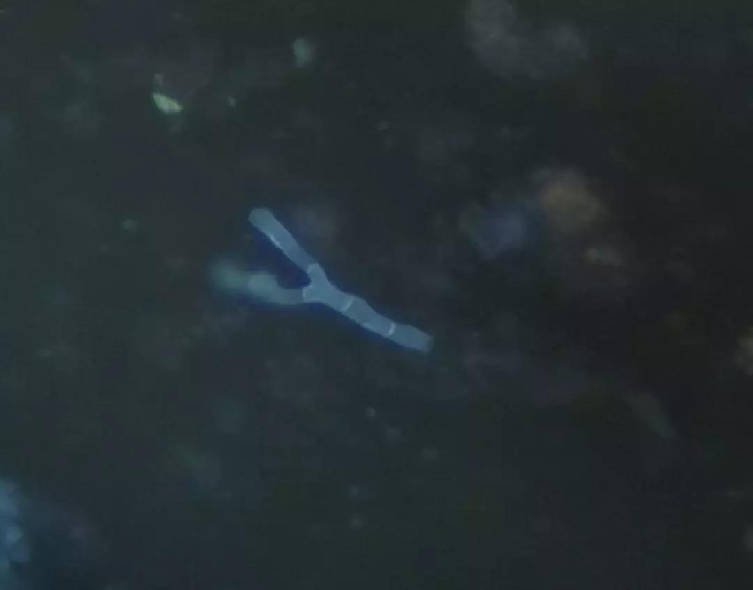 mngs病原检测的优势,mngs真的可靠吗