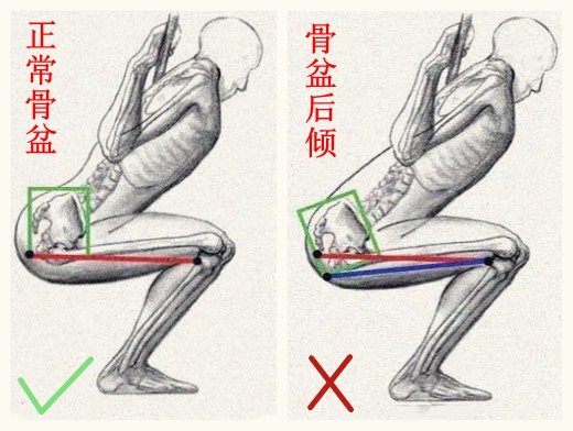 深蹲总是踮脚,深蹲老是拱腰