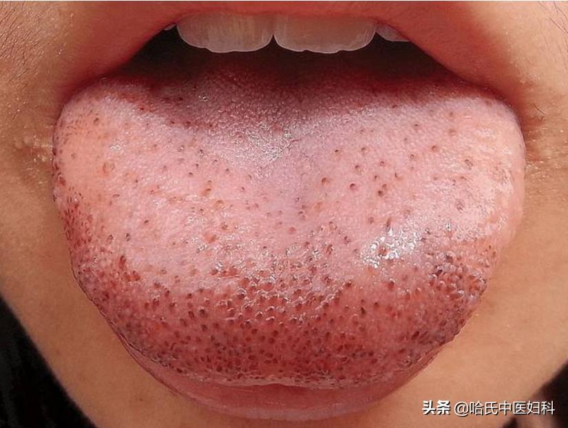 卵泡长不大萎缩怎么备孕,卵泡长不大怎么锻炼身体