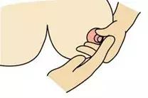 媳妇预产期都过了还没有动静,到了预产期还没动静必须剖腹产吗