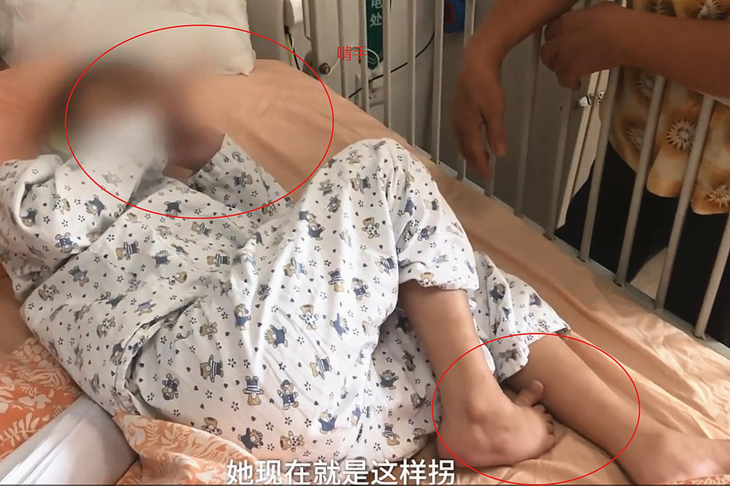 孩子被虫咬了发烧怎么办,小孩被恙虫咬会死吗